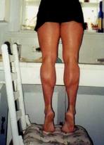 Legs
